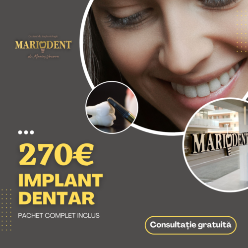 promotie implant dentar 270 euro